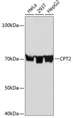 Invitrogen CPT2 Recombinant Rabbit Monoclonal Antibody (9V6M9) 100 &mu;L;
