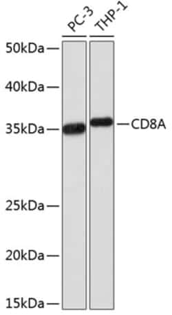 Invitrogen CD8a Recombinant Rabbit Monoclonal Antibody (3D6E4) 100 &mu;L | Buy Online | Invitrogen&trade; | Fisher Scientific