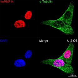 Invitrogen hnRNP K Recombinant Rabbit Monoclonal Antibody (3O5Y4) 100 &mu;L;