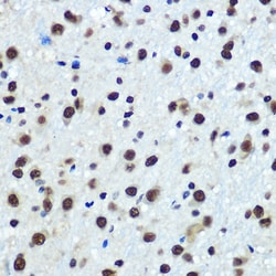 Invitrogen hnRNP K Recombinant Rabbit Monoclonal Antibody (3O5Y4) 100 &mu;L;