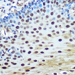 Invitrogen hnRNP K Recombinant Rabbit Monoclonal Antibody (3O5Y4) 100 &mu;L;