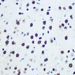 Invitrogen hnRNP K Recombinant Rabbit Monoclonal Antibody (3O5Y4) 100 &mu;L;