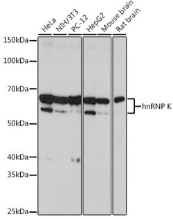 Invitrogen hnRNP K Recombinant Rabbit Monoclonal Antibody (3O5Y4) 100 &mu;L;