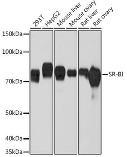 Invitrogen SR-BI Recombinant Rabbit Monoclonal Antibody (1C1I8) 100 &mu;L;