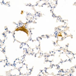 Invitrogen IGF1 Recombinant Rabbit Monoclonal Antibody (8W6E4) 100 &mu;L | Buy Online | Invitrogen&trade; | Fisher Scientific