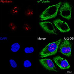 Invitrogen Fibrillarin Recombinant Rabbit Monoclonal Antibody (9J5O2) 100
