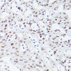 Invitrogen ISL1 Recombinant Rabbit Monoclonal Antibody (1G9Q8) 100 &mu;L;