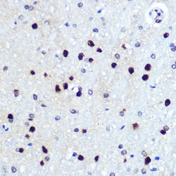 Invitrogen HES1 Recombinant Rabbit Monoclonal Antibody (9I2E8) 100 &mu;L;