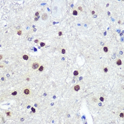 Invitrogen HES1 Recombinant Rabbit Monoclonal Antibody (9I2E8) 100 &mu;L;