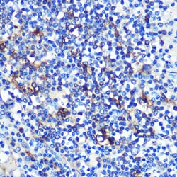 Invitrogen HLA-DRA Recombinant Rabbit Monoclonal Antibody (4Y9Y8) 100 &mu;L;