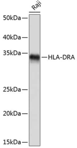 Invitrogen HLA-DRA Recombinant Rabbit Monoclonal Antibody (4Y9Y8) 100 &mu;L;