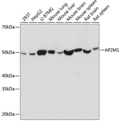 Invitrogen AP2M1 Recombinant Rabbit Monoclonal Antibody (10J8D1) 100 &mu;L | Buy Online | Invitrogen&trade; | Fisher Scientific