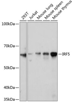 Invitrogen IRF5 Recombinant Rabbit Monoclonal Antibody (6L2B5) 100 &mu;L;