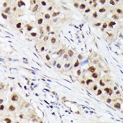 Invitrogen CDK4 Recombinant Rabbit Monoclonal Antibody (6N3M6) 100 &mu;L | Buy Online | Invitrogen&trade; | Fisher Scientific