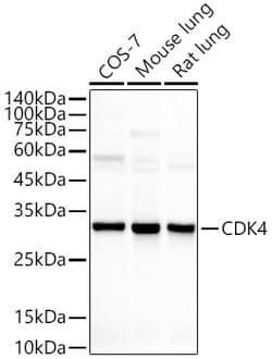 Invitrogen CDK4 Recombinant Rabbit Monoclonal Antibody (6N3M6) 100 &mu;L | Buy Online | Invitrogen&trade; | Fisher Scientific