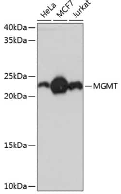 Invitrogen MGMT Recombinant Rabbit Monoclonal Antibody (2A4X3) 100 &mu;L;