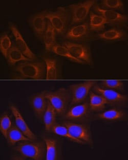 Invitrogen HSP27 Recombinant Rabbit Monoclonal Antibody (8V4B8) 100 &mu;L;