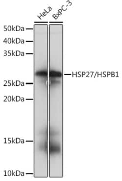 Invitrogen HSP27 Recombinant Rabbit Monoclonal Antibody (8V4B8) 100 &mu;L;