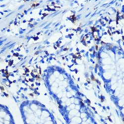 Invitrogen CD3z Recombinant Rabbit Monoclonal Antibody (1T5R7) 100 &mu;L;