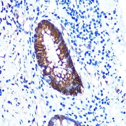 Invitrogen Galectin 3 Recombinant Rabbit Monoclonal Antibody (8F5F9) 100