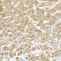 Invitrogen ATP Synthase beta Recombinant Rabbit Monoclonal Antibody (1H2W2)
