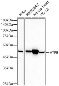 Invitrogen ATP Synthase beta Recombinant Rabbit Monoclonal Antibody (1H2W2)