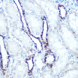 Invitrogen ATP5A1 Recombinant Rabbit Monoclonal Antibody (6M3B8) 100 &mu;L;