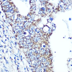 Invitrogen ATP5A1 Recombinant Rabbit Monoclonal Antibody (6M3B8) 100 &mu;L;