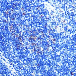 Invitrogen ATP5A1 Recombinant Rabbit Monoclonal Antibody (6M3B8) 100 &mu;L;