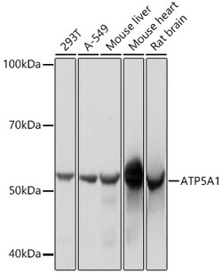 Invitrogen ATP5A1 Recombinant Rabbit Monoclonal Antibody (6M3B8) 100 &mu;L;