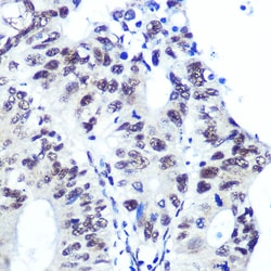 Invitrogen Ku70 Recombinant Rabbit Monoclonal Antibody (8L6B6) 100 &mu;L;