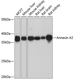 Invitrogen Annexin A2 Recombinant Rabbit Monoclonal Antibody (1W2B5) 100 &mu;L | Buy Online | Invitrogen&trade; | Fisher Scientific