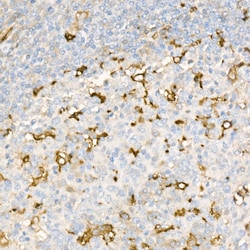 Invitrogen Ferritin Light Chain Recombinant Rabbit Monoclonal Antibody