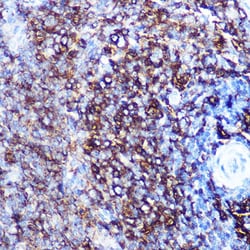 Invitrogen HLA-DQA1 Recombinant Rabbit Monoclonal Antibody (7W0M7) 100