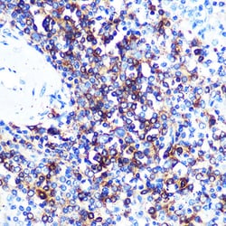 Invitrogen HLA-DQA1 Recombinant Rabbit Monoclonal Antibody (7W0M7) 100