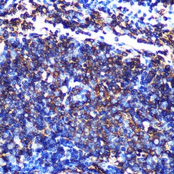 Invitrogen HLA-DQA1 Recombinant Rabbit Monoclonal Antibody (7W0M7) 100