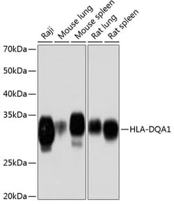 Invitrogen HLA-DQA1 Recombinant Rabbit Monoclonal Antibody (7W0M7) 100