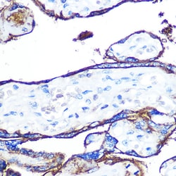 Invitrogen CD55 Recombinant Rabbit Monoclonal Antibody (2T4V4) 100 &mu;L;