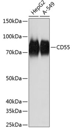 Invitrogen CD55 Recombinant Rabbit Monoclonal Antibody (2T4V4) 100 &mu;L;