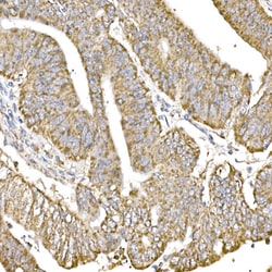 Invitrogen C1QBP Recombinant Rabbit Monoclonal Antibody (6N7U3) 100 &mu;L;