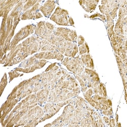 Invitrogen C1QBP Recombinant Rabbit Monoclonal Antibody (6N7U3) 100 &mu;L;