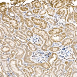Invitrogen C1QBP Recombinant Rabbit Monoclonal Antibody (6N7U3) 100 &mu;L;