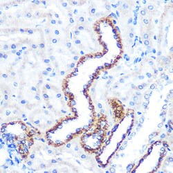 Invitrogen Angiopoietin 2 Recombinant Rabbit Monoclonal Antibody (5H8U4) 100 &mu;L | Buy Online | Invitrogen&trade; | Fisher Scientific