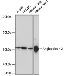 Invitrogen Angiopoietin 2 Recombinant Rabbit Monoclonal Antibody (5H8U4) 100 &mu;L | Buy Online | Invitrogen&trade; | Fisher Scientific