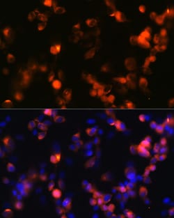 Invitrogen GluR2 Recombinant Rabbit Monoclonal Antibody (9R1X2) 100 &mu;L;