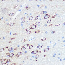 Invitrogen GluR2 Recombinant Rabbit Monoclonal Antibody (9R1X2) 100 &mu;L;