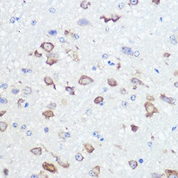 Invitrogen GluR2 Recombinant Rabbit Monoclonal Antibody (9R1X2) 100 &mu;L;
