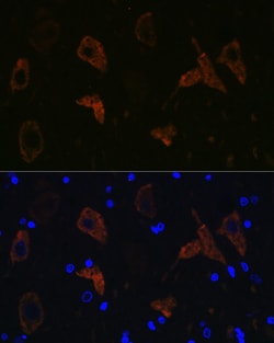 Invitrogen GluR2 Recombinant Rabbit Monoclonal Antibody (9R1X2) 100 &mu;L;