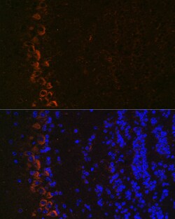Invitrogen GluR2 Recombinant Rabbit Monoclonal Antibody (9R1X2) 100 &mu;L;