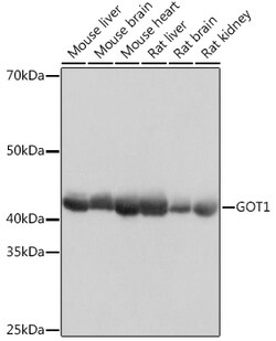 Invitrogen GOT1 Recombinant Rabbit Monoclonal Antibody (5J1B4) 100 &mu;L;